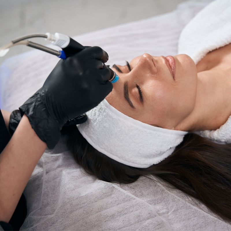  Laser hair reduction 